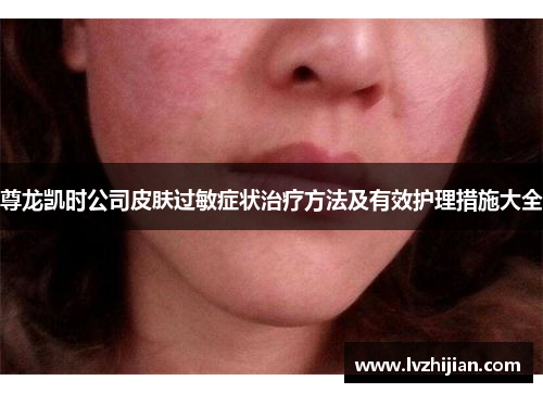 尊龙凯时公司皮肤过敏症状治疗方法及有效护理措施大全 尊龙凯时公司皮肤过敏症状治疗方法及有效护理措施大全